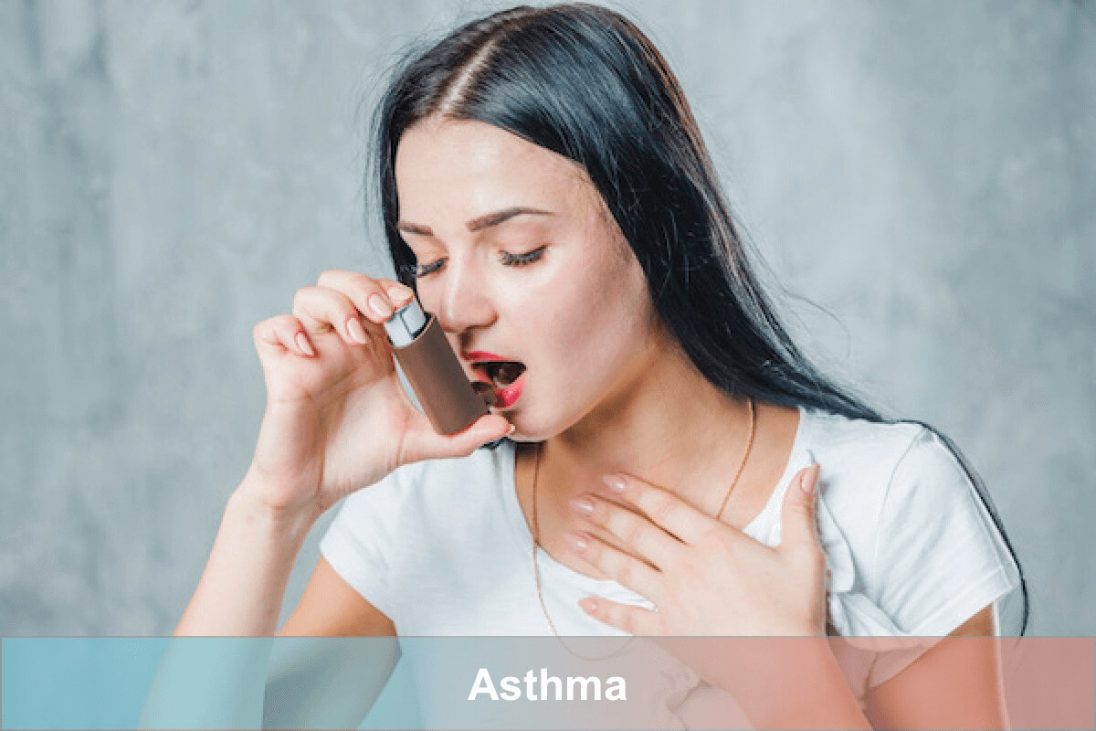 Asthma Pump | Generic Pharmacy Online