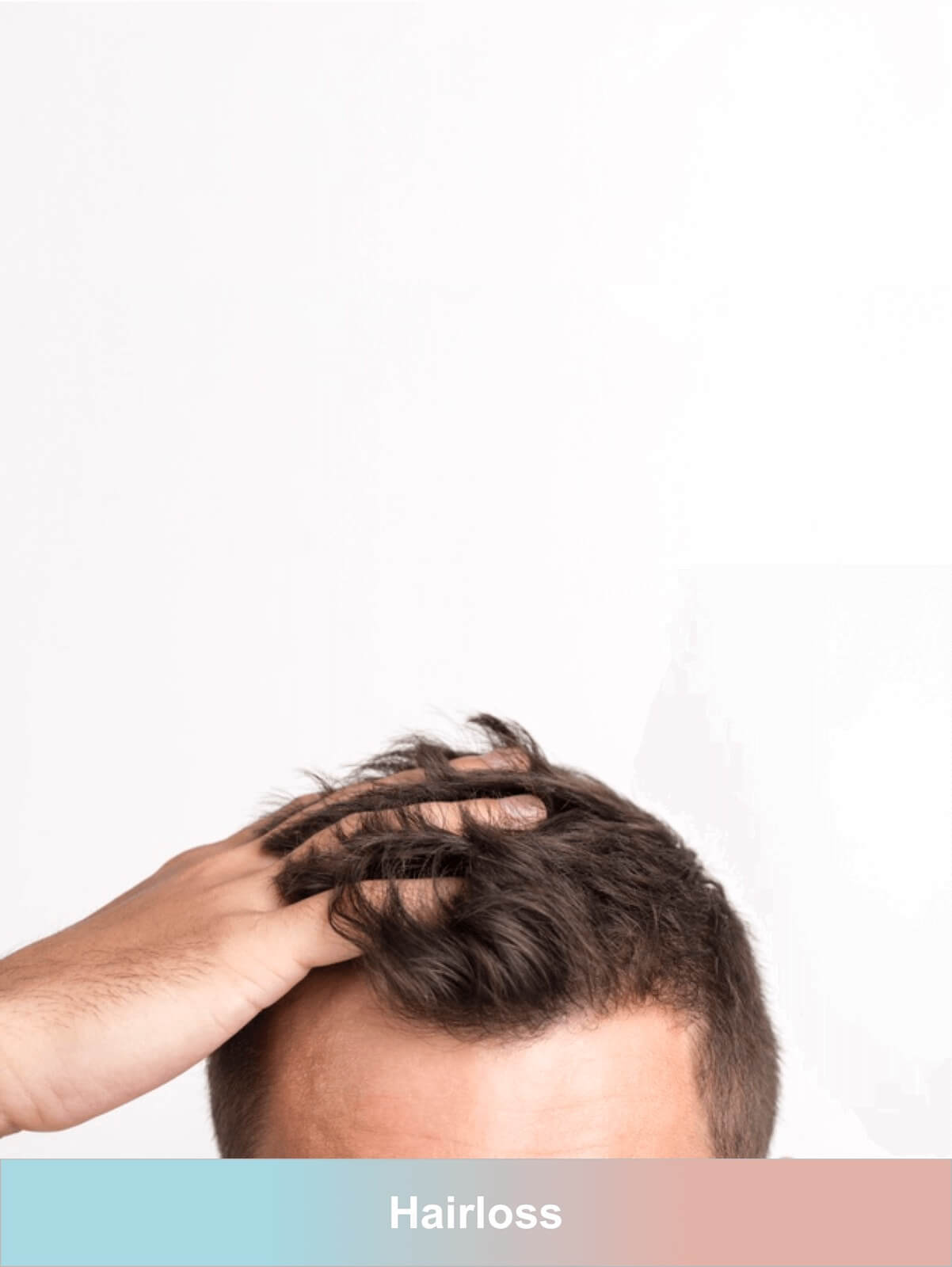 hairloss is worst condition men face causing there low self esteem. Buy online at allgenericcure mens hair loss products