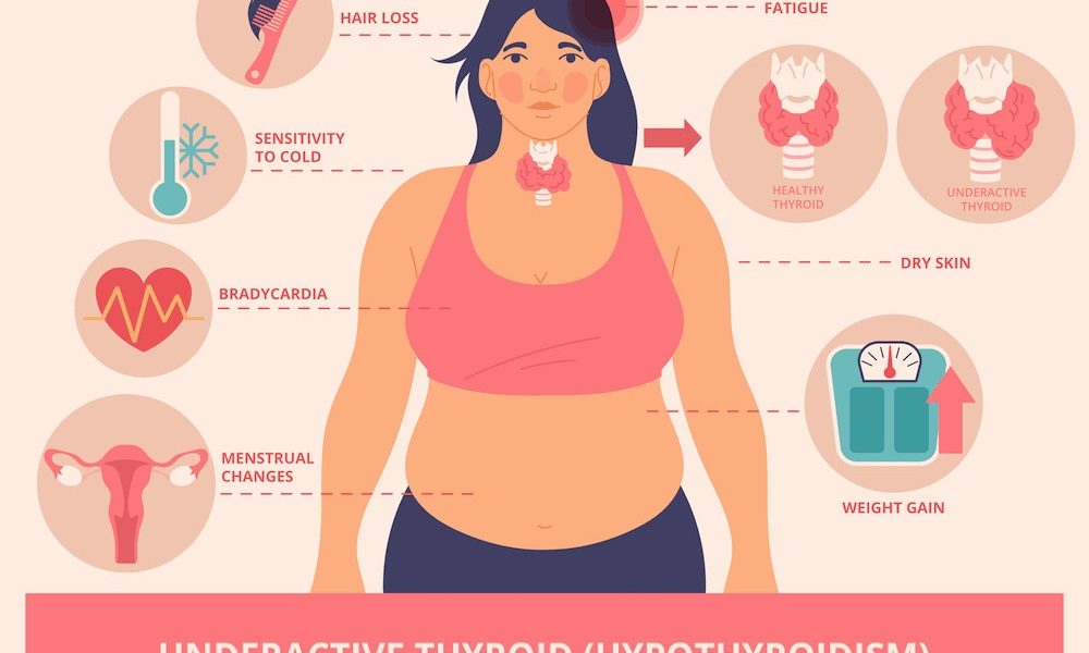 thyroid care with T4 thyronorm